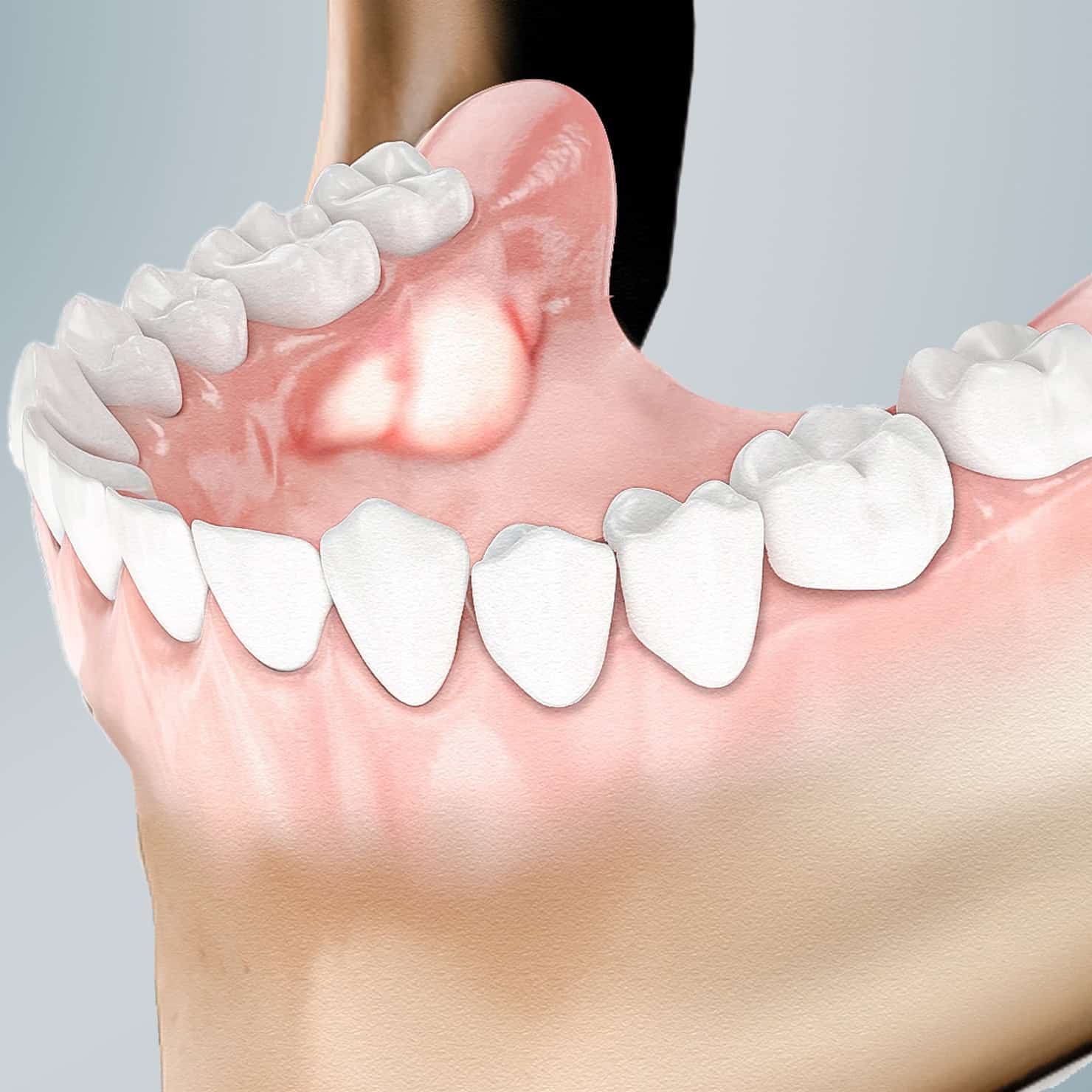 procedure